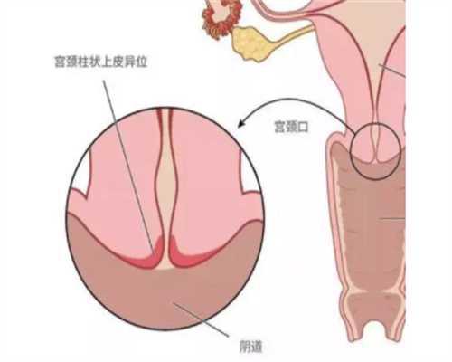 北京协和医院生殖科哪个医生做试管婴儿成功率高？