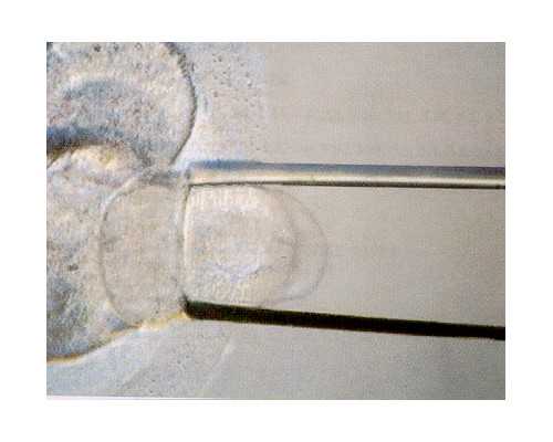 在北京三院做试管婴儿大概需要多少钱啊？5万够吗？