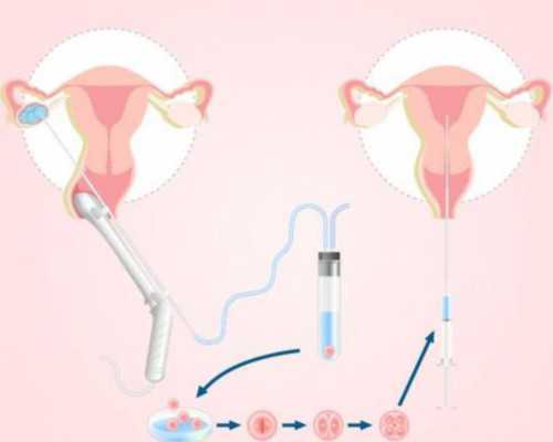 喜得尔国际试管中心,北京喜得尔试管中心地址