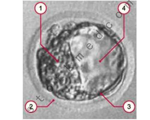 为什么孕期会有狐臭味