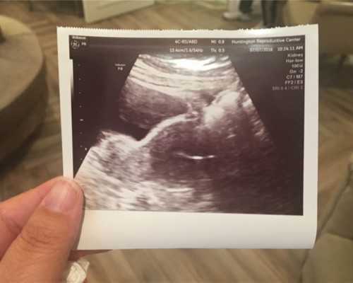 北京试管代怀百科,北京试管婴儿价格要多少,北京试管婴儿多少钱