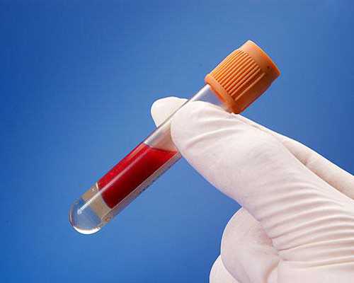 北京双胞胎代怀供卵机构,北京三医院进行一次三代试管需要哪些费用？?