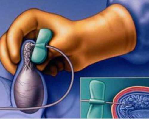 北京借卵供卵中心,北京不孕不育医院前三名？北京试管医院哪家好？