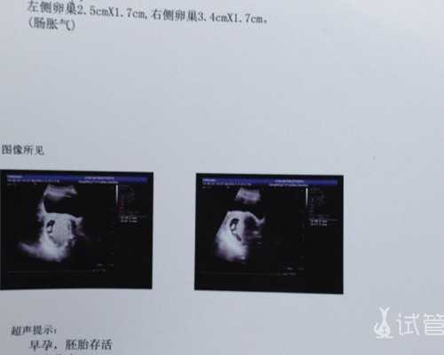 北京专业代怀收费,北京供卵试管公司，北京试管婴儿流程