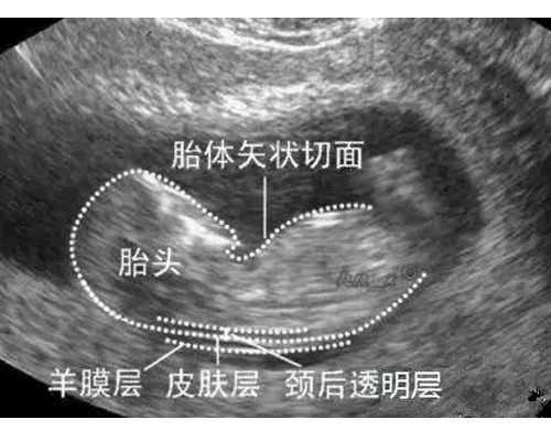 北京代生可供精卵,北京供卵中心靠谱吗,北京供卵试管中介靠谱吗