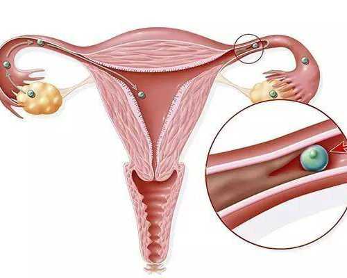 北京定制代孕套餐,北京私立医院试管排名？北京家圆医院