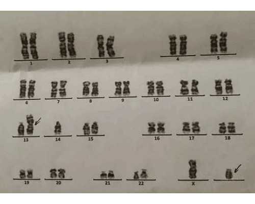 北京最好试管代孕,北京哪里试管婴儿好 分几种