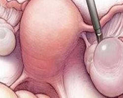 北京哪家医院好做代孕,北京三医院试管专家,北京三医院试管成功率