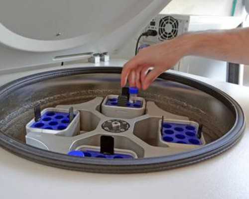 北京代生安全吗,2024北京协和医院供卵试管多少钱？附北京供卵试管费用一览表