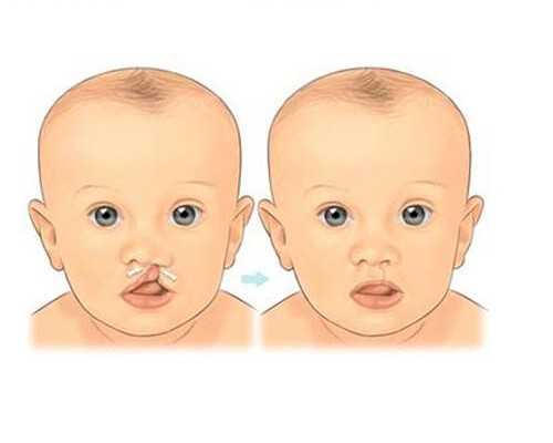 北京哪有供卵,北京哪里可以做三代试管男孩？北京三代试管成功率是多少？