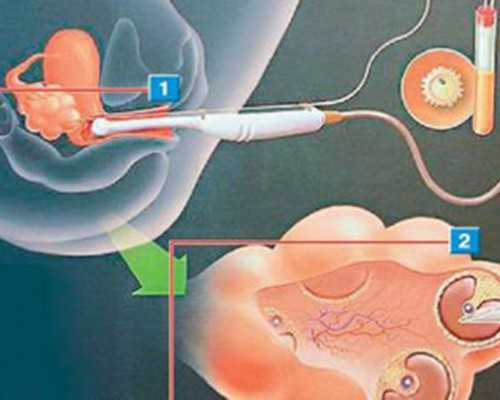 北京找代怀合法吗|济宁供卵试管婴儿医院排名，2024本地热门助孕机构大全