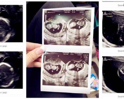 2024年非婚生子随母姓落户北京的最新规定是什么？