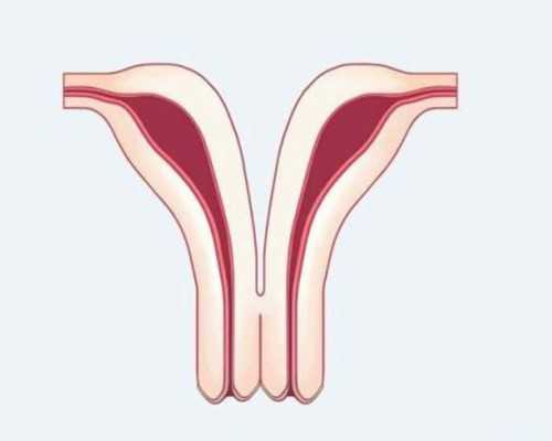 月经期第一天痛经怎么办