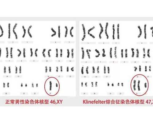 北京北医三院做供精试管，单购买精子大概多少钱？