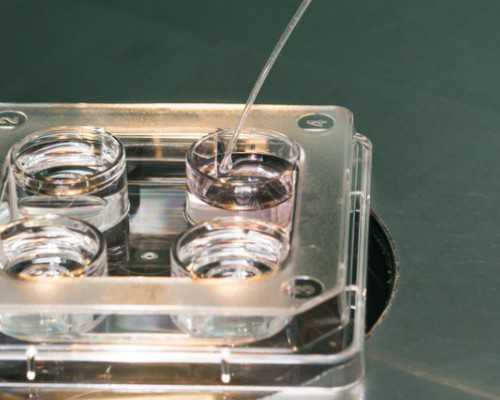 英格兰对苏格兰的统治手段，对苏格兰政府有哪些影响？