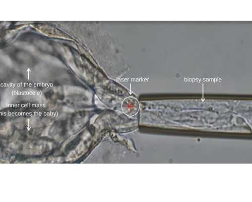 哈尔滨三代供卵试管婴儿医院排名？附哈尔滨试管助孕成功率？