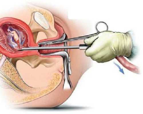 北京代孕哪做的最好,北京看妇科病医院电话