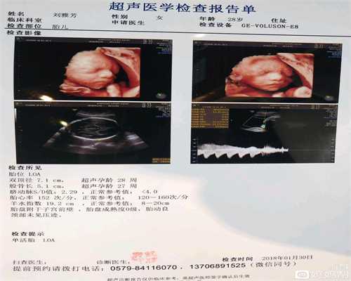 北京代妈公司_卵巢早衰能医好吗可以怀孕吗_试管婴儿二级胚胎好吗_试管婴儿