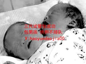 北京试管包机联系电话_北京代妈中介_试管婴儿关键步骤_试管婴儿的具体步骤