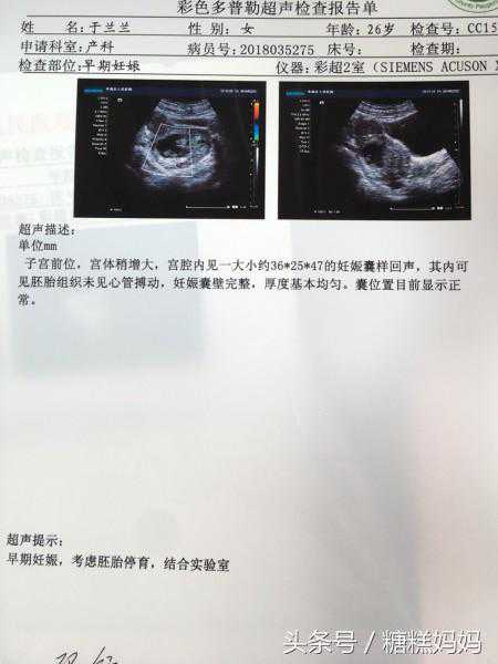 北京代孕那家医院_北京代怀代生男宝宝_失败了，胎停，真的很伤心，不知道还