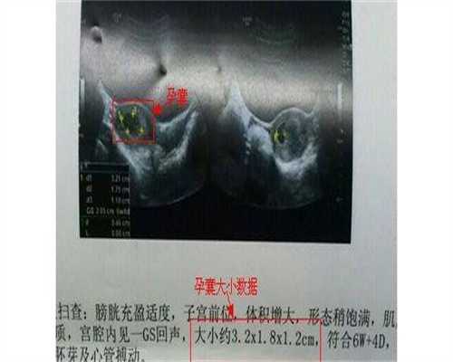 DMD试管