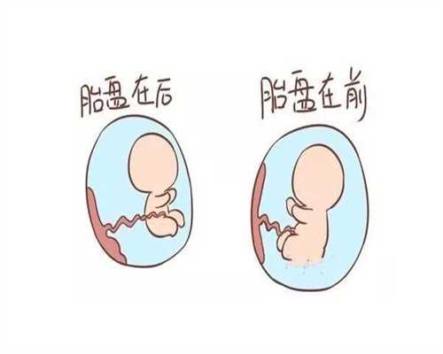 苏州单身女性做试管，宫腔粘连如何顺利过检？